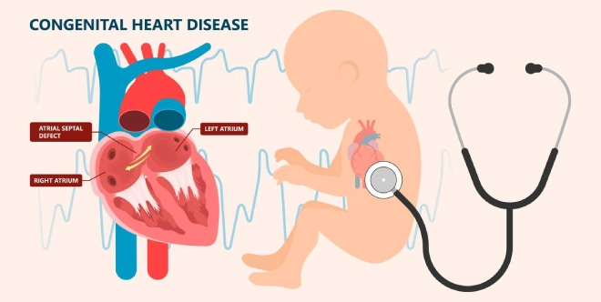 Congenital heart disease: